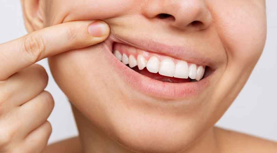 Upgrading Your Smile Without the Usual Hassle