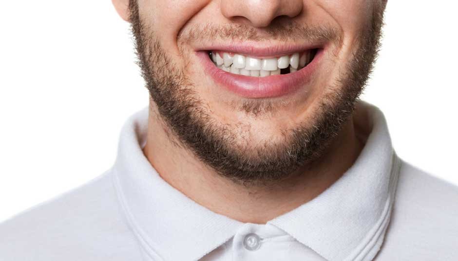 Bone Loss and Tooth Loss: How One Missing Tooth Affects Your Entire Jaw